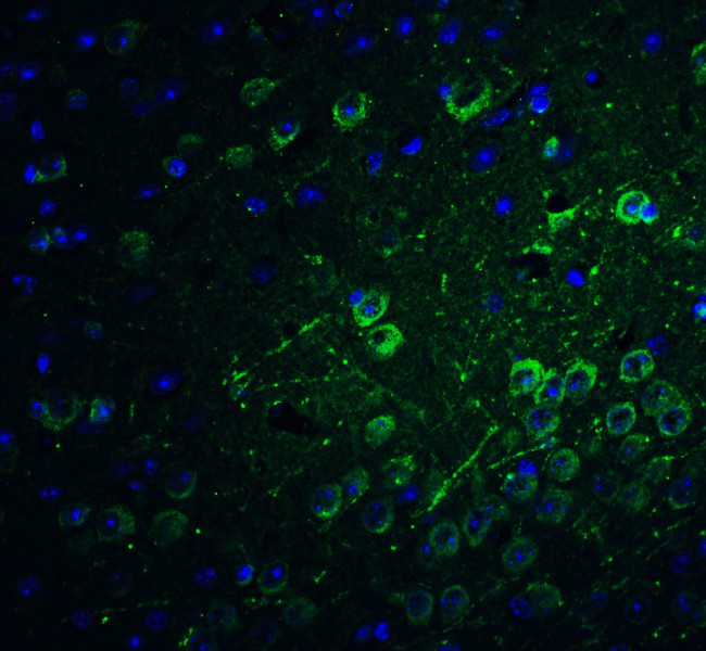 PACS1 Antibody in Immunohistochemistry (IHC)