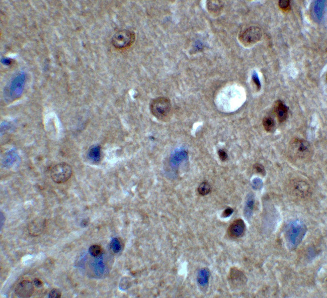 PACS1 Antibody in Immunohistochemistry (IHC)