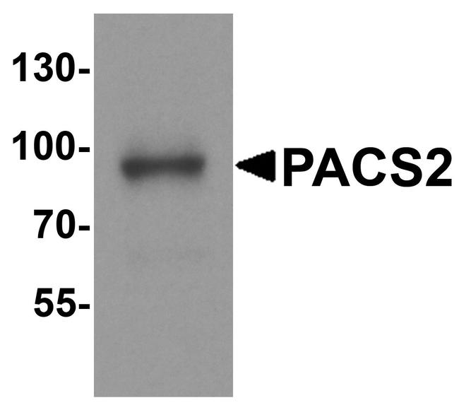 PACS2 Antibody in Western Blot (WB)