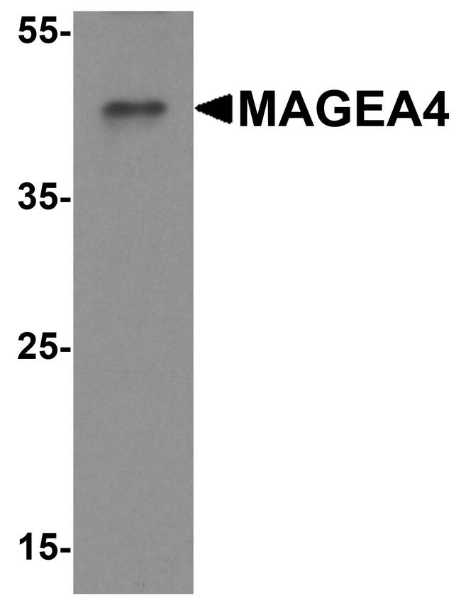 MAGEA4 Antibody in Western Blot (WB)