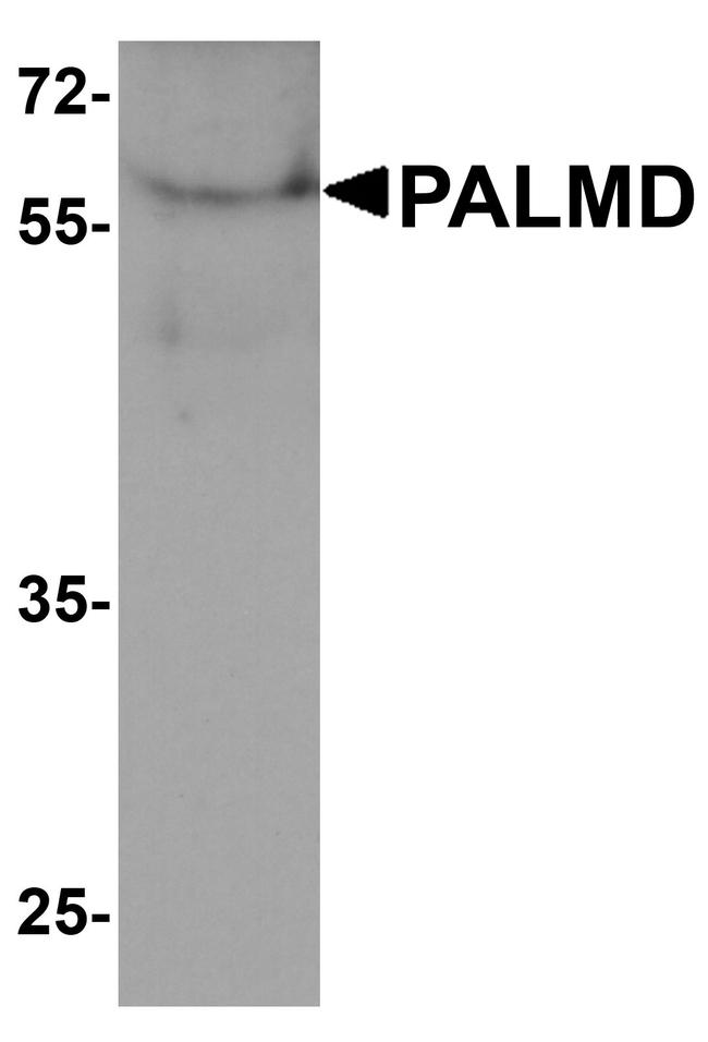PALMD Antibody in Western Blot (WB)