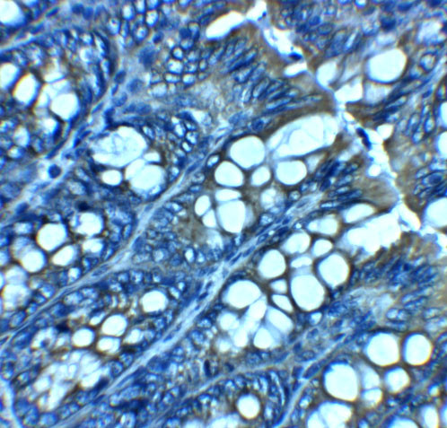 JAGN1 Antibody in Immunohistochemistry (Paraffin) (IHC (P))