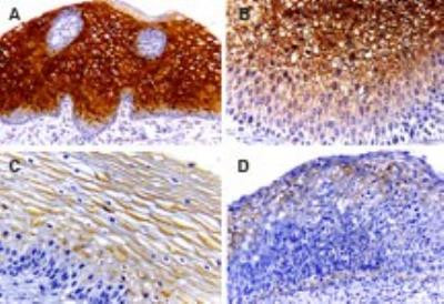 Caspase 14 Antibody in Immunohistochemistry (Paraffin) (IHC (P))