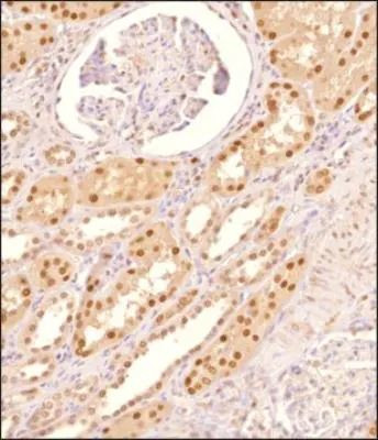 MAT2A Antibody in Immunohistochemistry (Paraffin) (IHC (P))