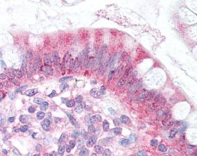 NPC1L1 Antibody in Immunohistochemistry (Paraffin) (IHC (P))