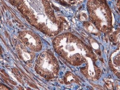 ATF3 Antibody in Immunohistochemistry (Paraffin) (IHC (P))