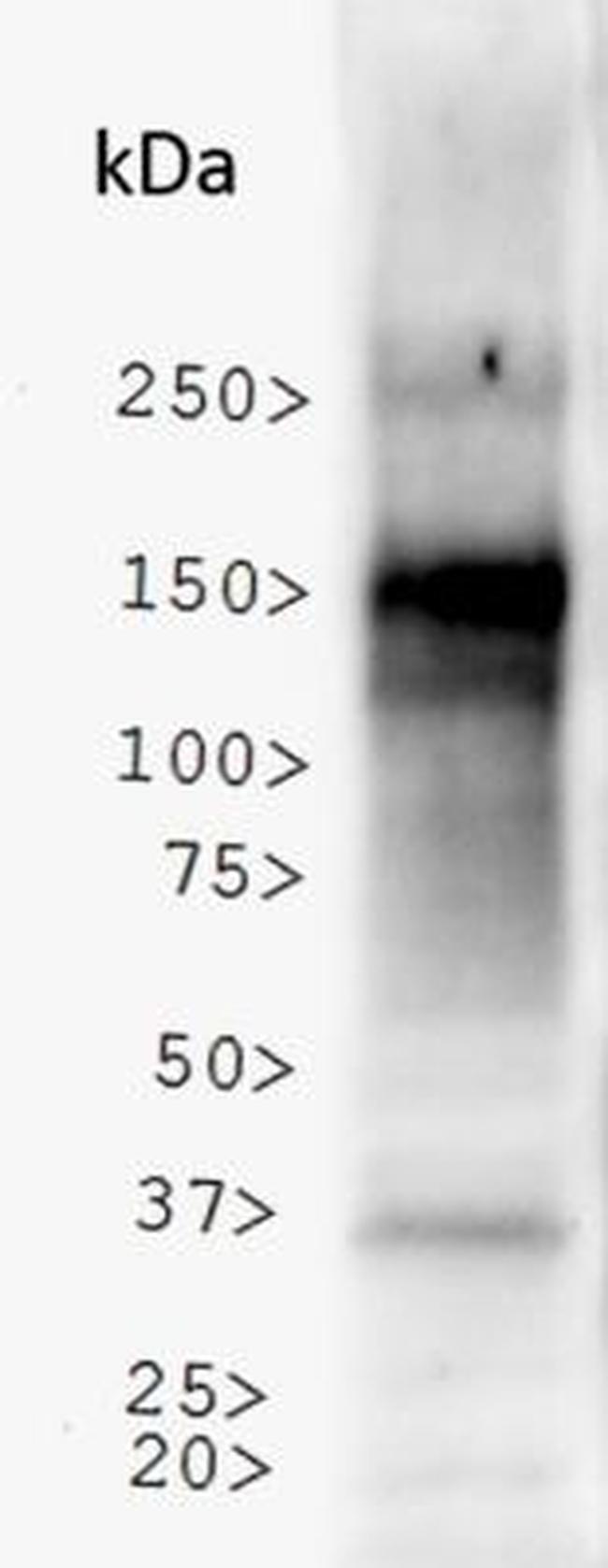 NBR1 Antibody in Western Blot (WB)