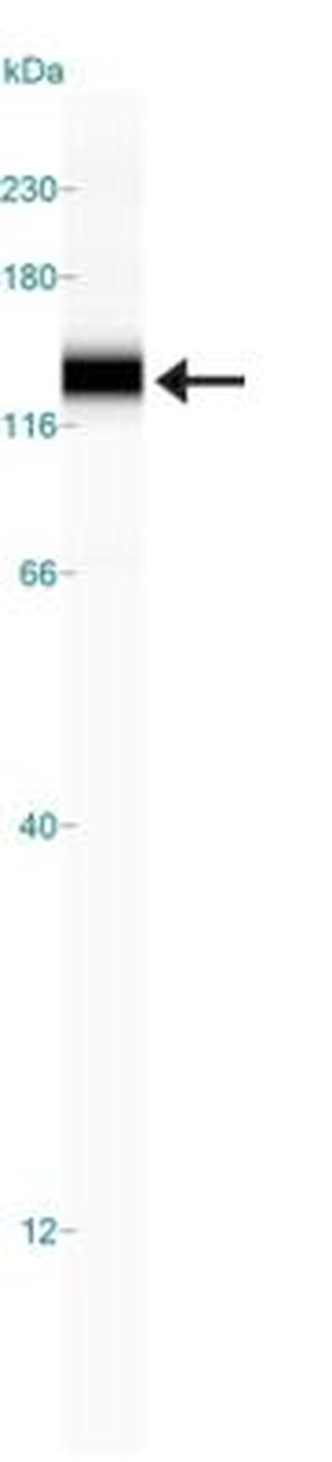 NBR1 Antibody in Western Blot (WB)