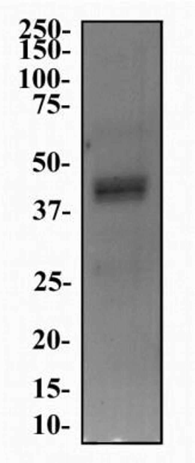 HTR4 Antibody in Western Blot (WB)