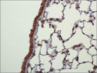 NLRC4 Antibody in Immunohistochemistry (Paraffin) (IHC (P))