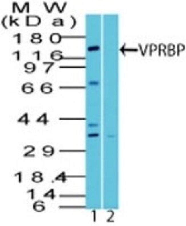 VPRBP Antibody in Western Blot (WB)