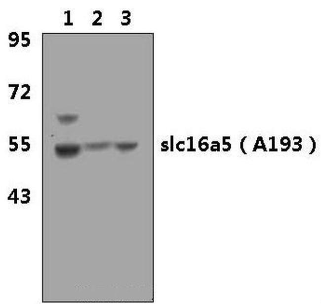 MCT5 Antibody in Western Blot (WB)