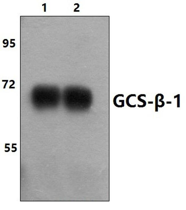 GUCY1B3 Antibody in Western Blot (WB)