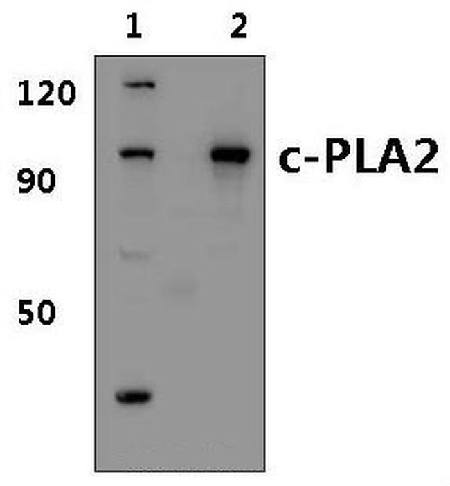 PLA2G4A Antibody in Western Blot (WB)