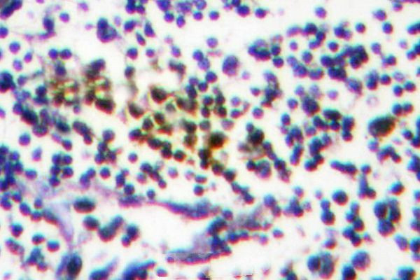 NYREN18 Antibody in Immunohistochemistry (Paraffin) (IHC (P))