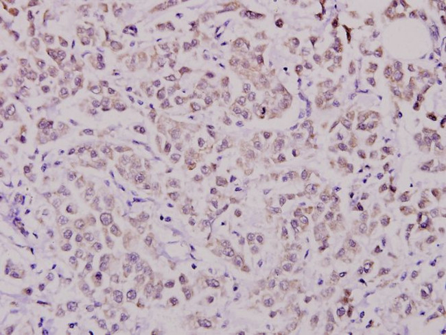 WAVE1 Antibody in Immunohistochemistry (Paraffin) (IHC (P))