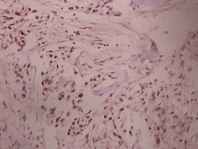 PRKAR1A Antibody in Immunohistochemistry (Paraffin) (IHC (P))