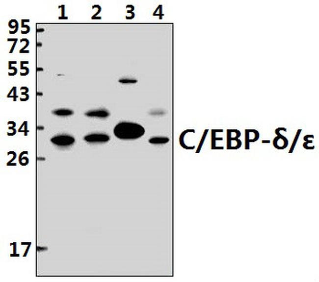 C/EBP delta/epsilon Antibody in Western Blot (WB)