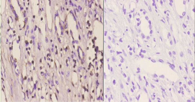 YBX2 Antibody in Immunohistochemistry (Paraffin) (IHC (P))