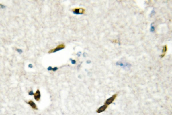 RBMX Antibody in Immunohistochemistry (Paraffin) (IHC (P))