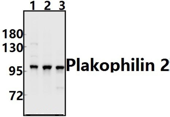PKP2 Antibody in Western Blot (WB)