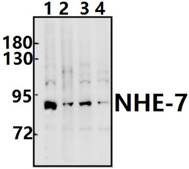 SLC9A7 Antibody in Western Blot (WB)