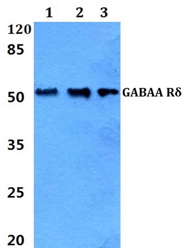 GABRD Antibody in Western Blot (WB)