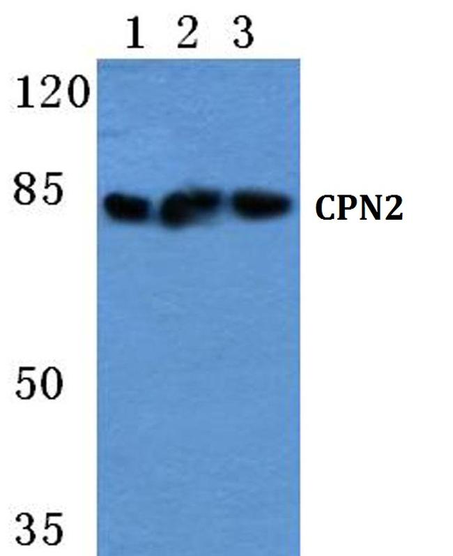 CPN2 Antibody in Western Blot (WB)