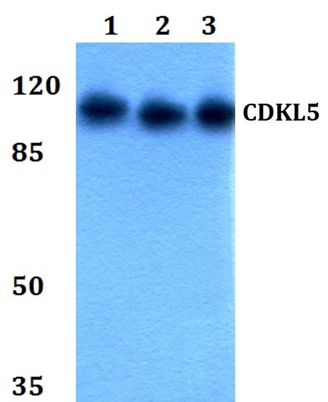 CDKL5 Antibody in Western Blot (WB)