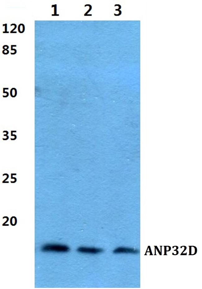 ANP32D Antibody in Western Blot (WB)