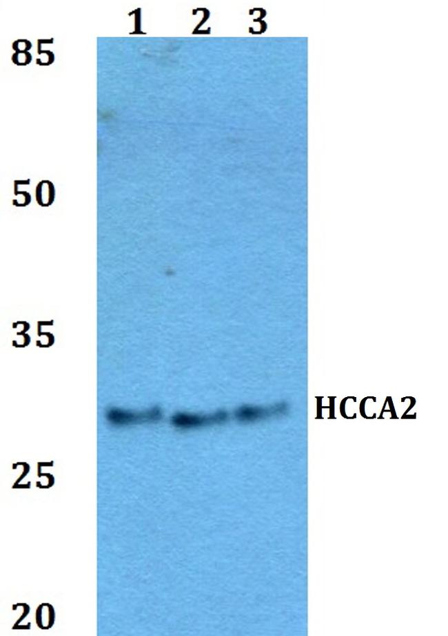 MOB2 Antibody in Western Blot (WB)