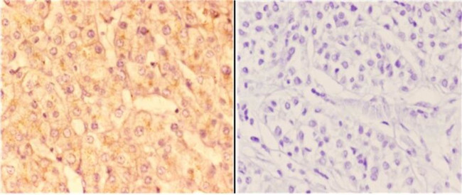 ABCC11 Antibody in Immunohistochemistry (Paraffin) (IHC (P))