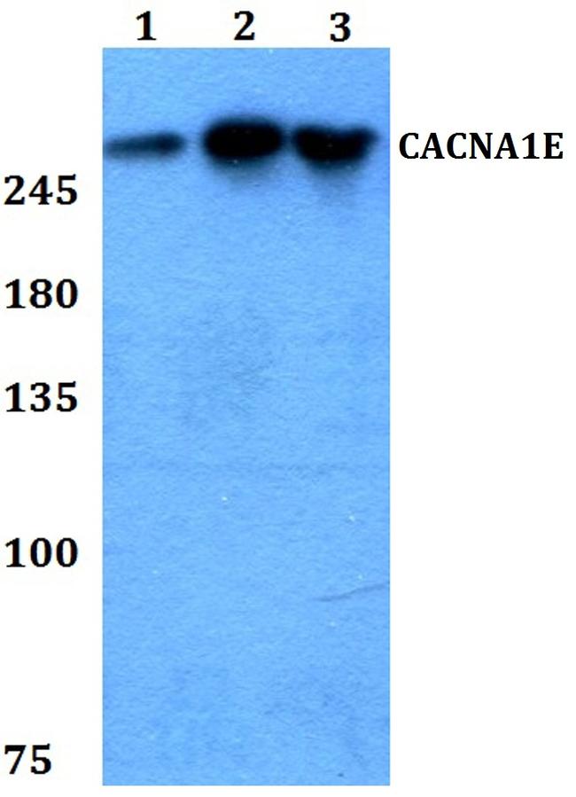 CaV2.3 Antibody in Western Blot (WB)