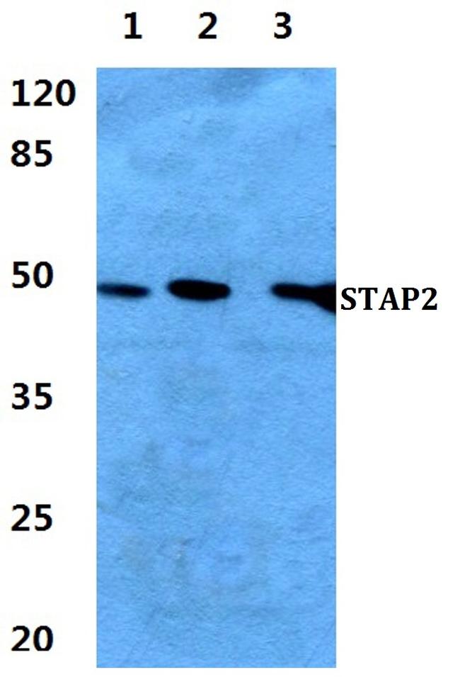 STAP2 Antibody in Western Blot (WB)