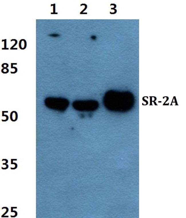 HTR2A Antibody in Western Blot (WB)