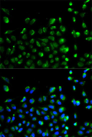 ATG13 Antibody in Immunocytochemistry (ICC/IF)