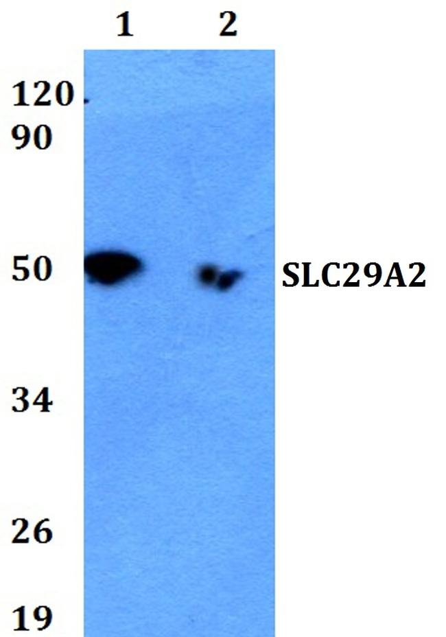 ENT2 Antibody in Western Blot (WB)