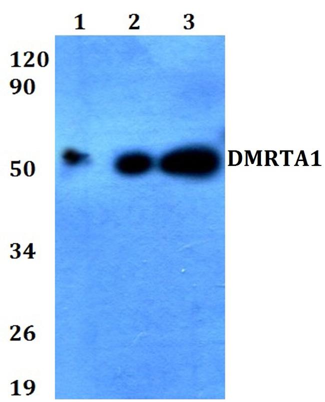 DMRTA1 Polyclonal Antibody
