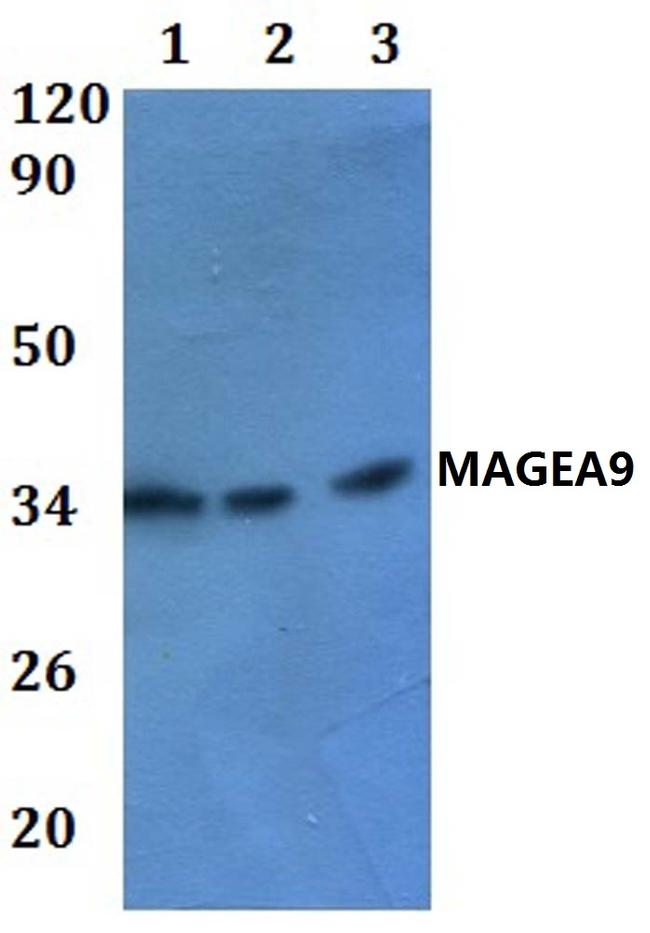 MAGEA9 Antibody in Western Blot (WB)