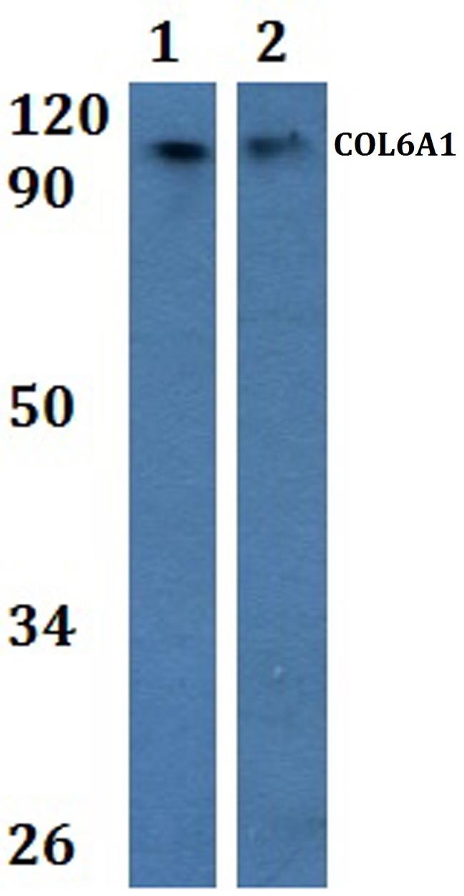 COL6A1 Antibody in Western Blot (WB)