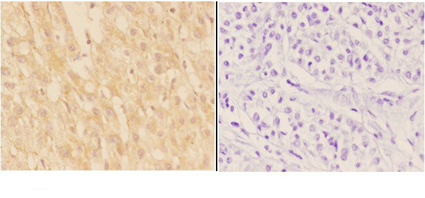 ADAMTS7 Antibody in Immunohistochemistry (Paraffin) (IHC (P))