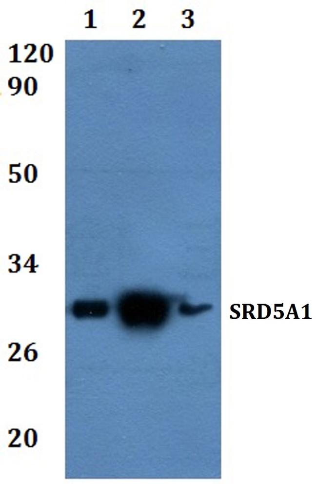 SRD5A1 Antibody in Western Blot (WB)