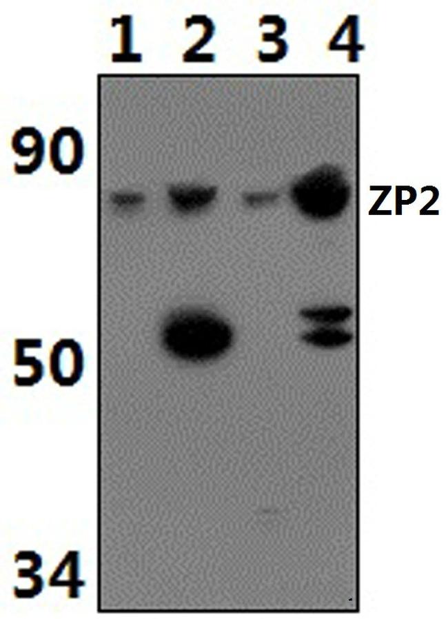 ZP2 Antibody in Western Blot (WB)