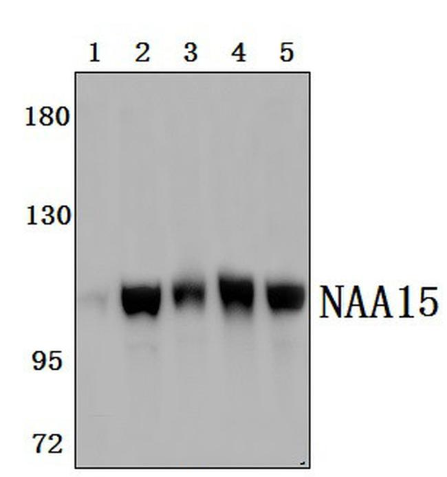 NAA15 Antibody in Western Blot (WB)