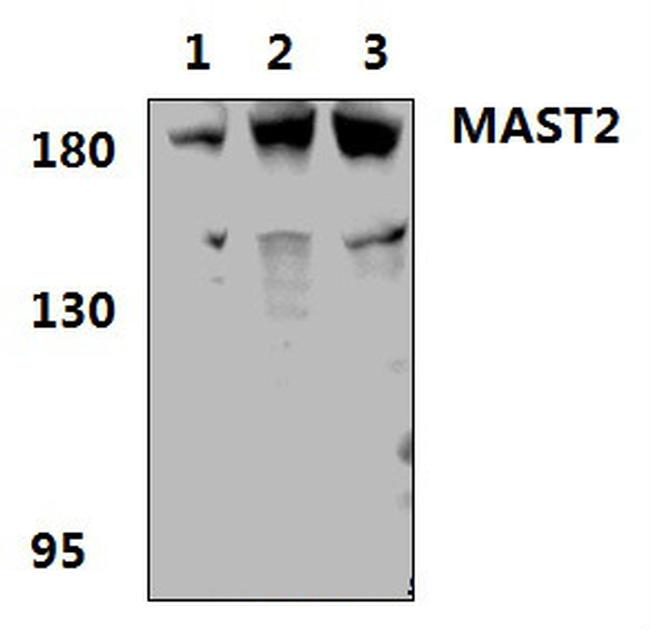 MAST2 Antibody in Western Blot (WB)