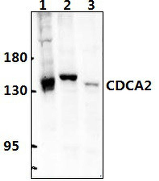 CDCA2 Antibody in Western Blot (WB)