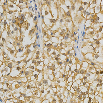 GRK3 Antibody in Immunohistochemistry (Paraffin) (IHC (P))