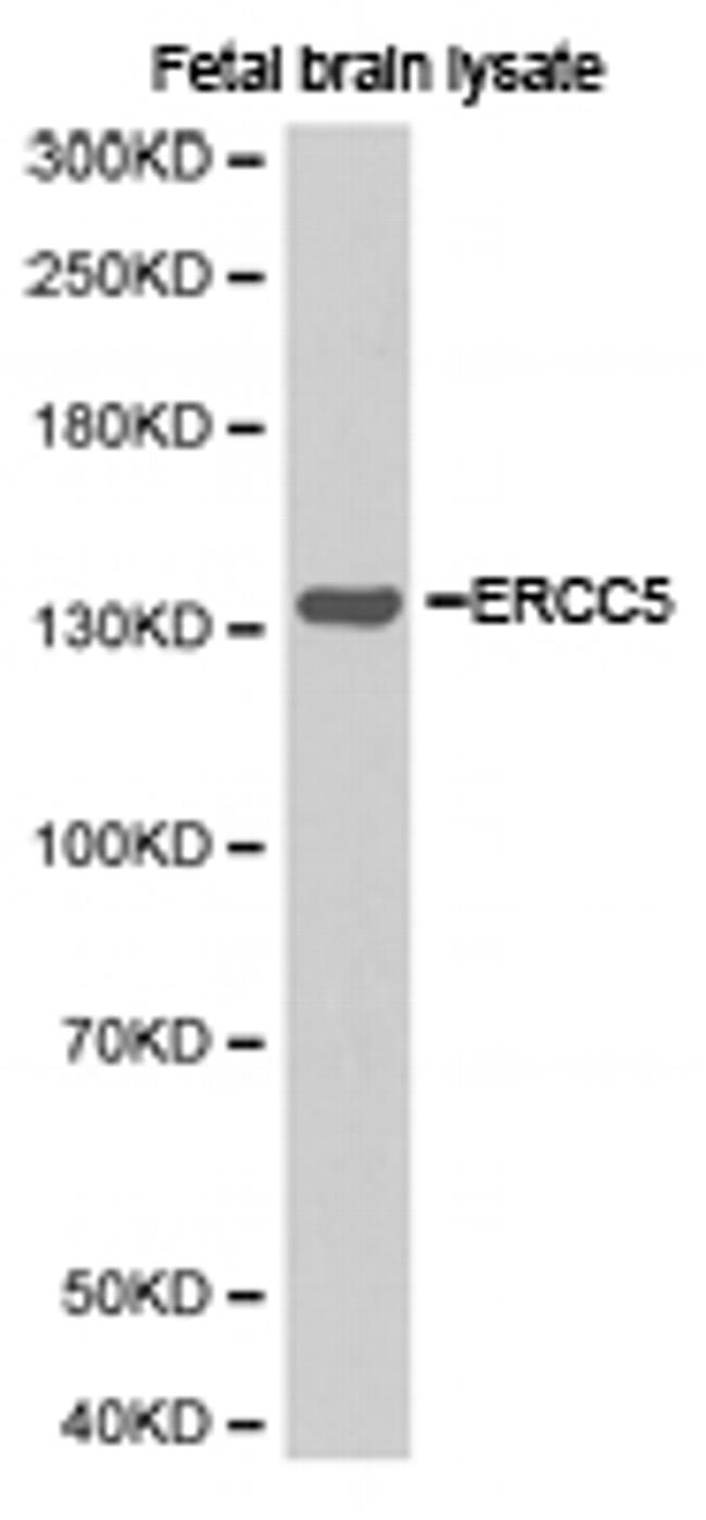 XPG Antibody in Western Blot (WB)