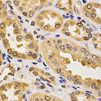 PON2 Antibody in Immunohistochemistry (Paraffin) (IHC (P))