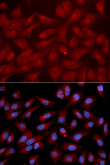 RAPGEF3 Polyclonal Antibody (PA5-76094)